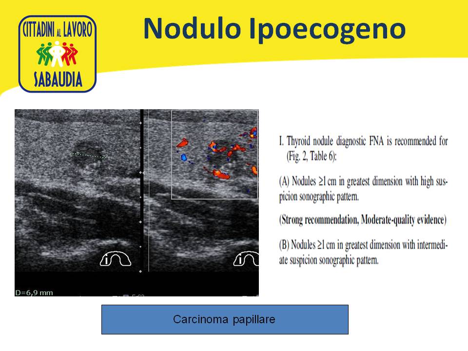 Diapositiva361