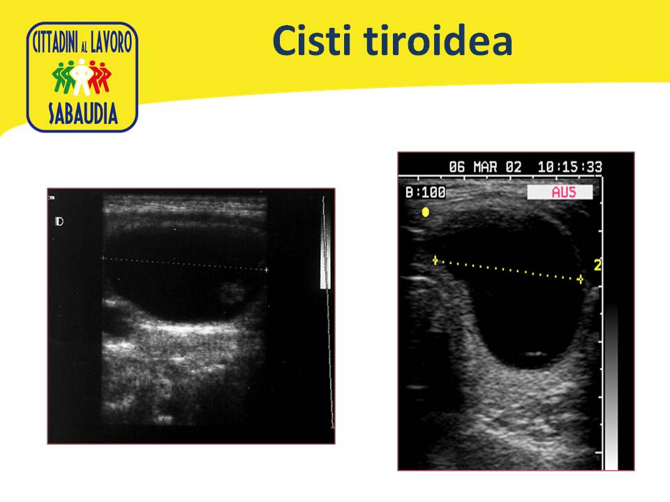 Diapositiva58